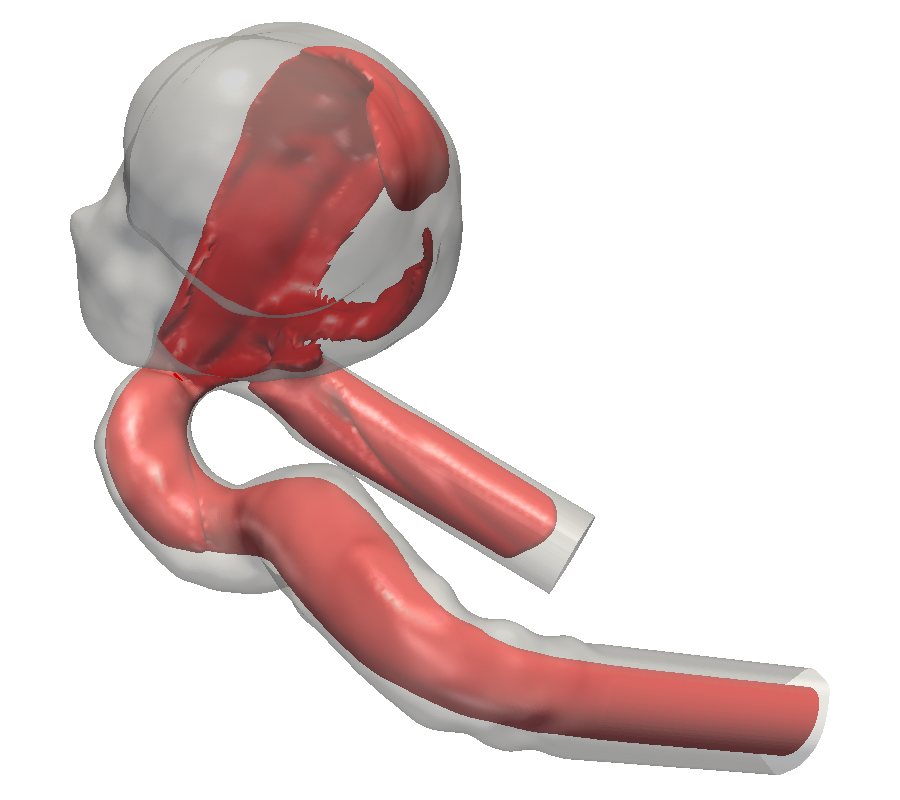 Illustration of flow field in a patient-specific intra-cranial aneurysm geometry. Simulation performed using ALBORZ by M.Sc. Feng Huang (currently Ph.D. student at the LSS). Illustration of flow field in a patient-specific intra-cranial aneurysm geometry. Simulation performed using ALBORZ by M.Sc. Feng Huang (currently Ph.D. student at the LSS).